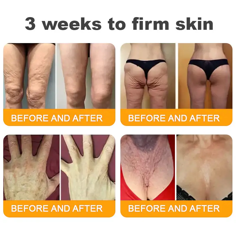 Made and Shipped from USA ✨ TLOPA® Bee Venom Skin Restoration Cream ⏰ LAST DAY 80% OFF🍓