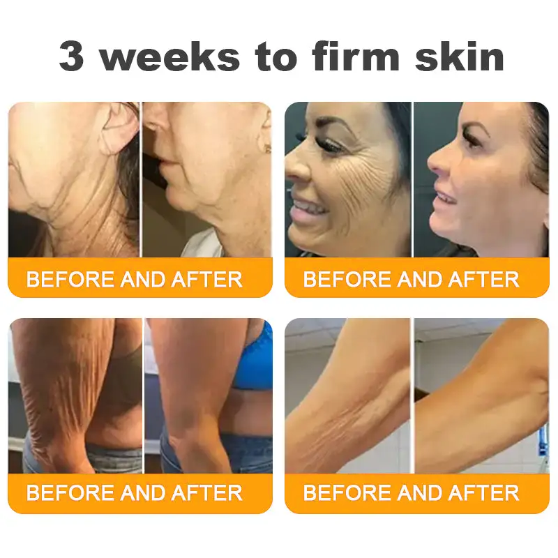 Made and Shipped from USA ✨ TLOPA® Bee Venom Skin Restoration Cream ⏰ LAST DAY 80% OFF💖💖